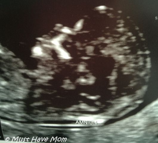 And Baby Makes 4! That’s Right We Are Expecting Baby #4!!! And Why We Decided To Have Another Baby…