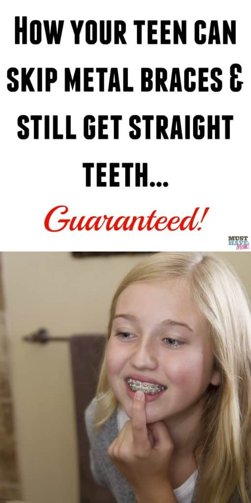 How your teen can skip braces and get straight teeth guaranteed! No braces required! Check out these tips and save your teen from having to get metal braces.