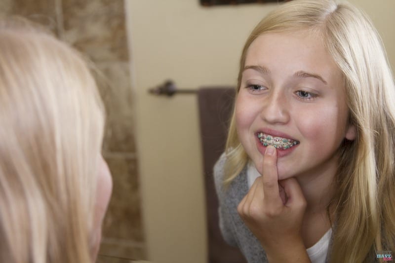 How your teen can skip braces and get straight teeth guaranteed! No braces required! Check out these tips and save your teen from having to get metal braces.