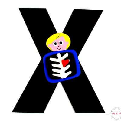 X is for X-Ray Letter Craft {Free Printables}